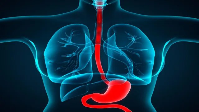 what is a jackhammer esophagus